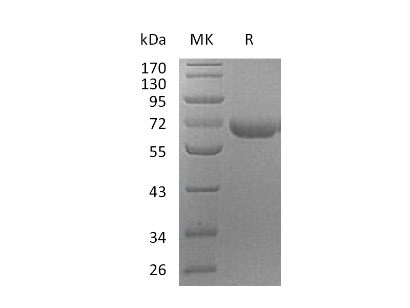 Recombinant Human PRCP (C-6His)