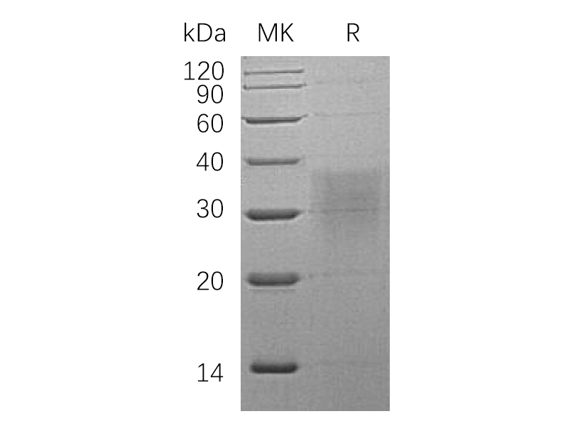 Recombinant Human BMPR2 (C-6His)