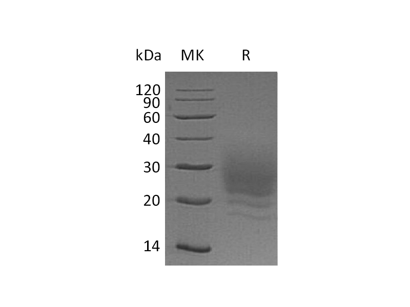 Recombinant Human BOC (C-6His)