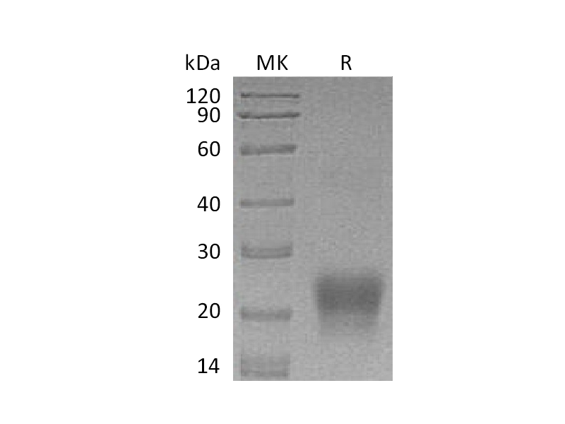 Recombinant Human BST2 (C-6His)