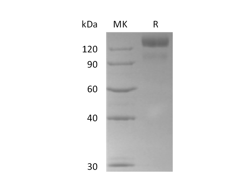 Recombinant Human BAI3 (C-6His)