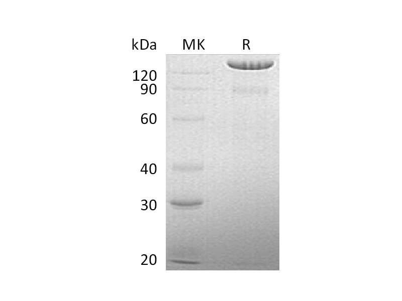Recombinant Human BCAN (C-6His)
