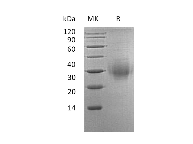 Recombinant Human BTLA (C-6His)