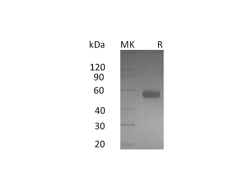 Recombinant Human BTLA (C-Fc)