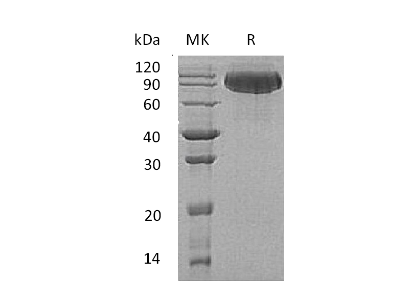 Recombinant Human BCHE (C-6His)