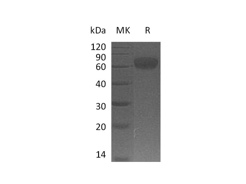 Recombinant Human VISTA (C-Fc)