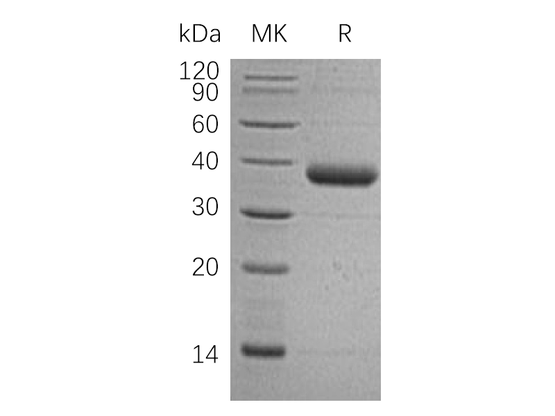 Recombinant Human C1QTNF1 (C-6His)