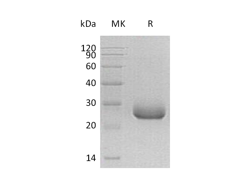 Recombinant Human PRADC1 (C-6His)