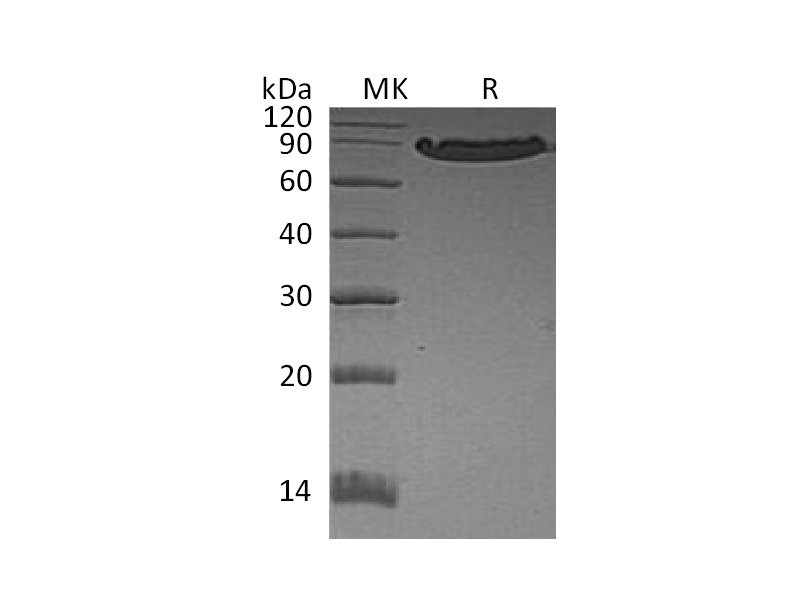 Recombinant Human CDH1 (C-6His)
