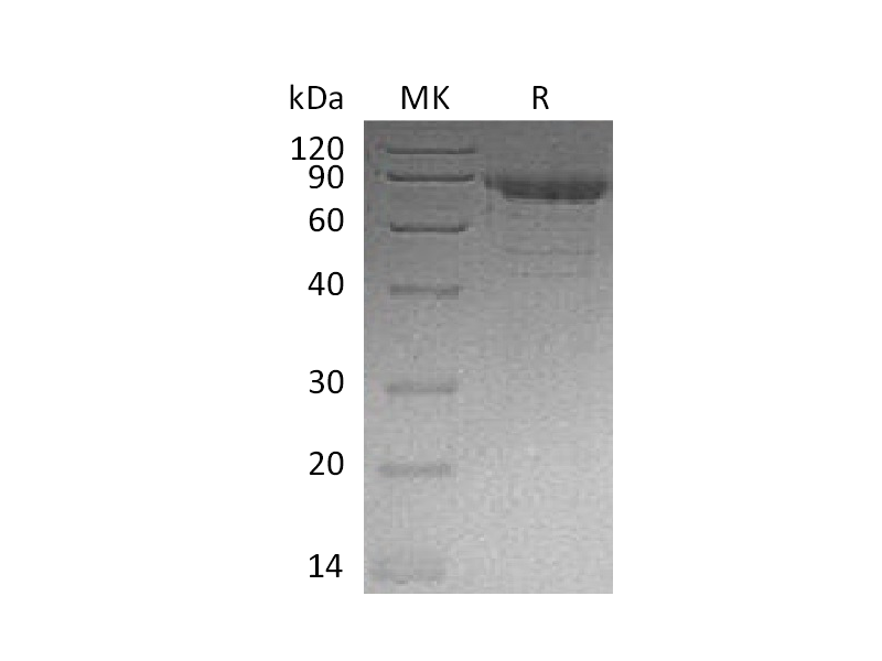 Recombinant Human CDH11 (C-6His)