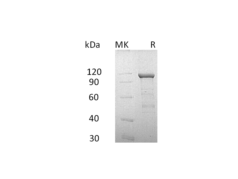 Recombinant Human CDH11 (C-Fc-6His)