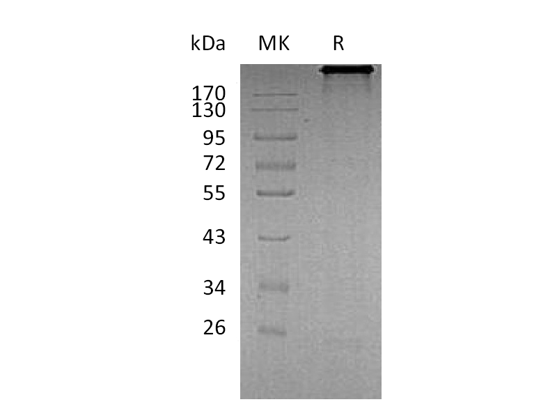 Recombinant Human CDH6 (C-Fc)