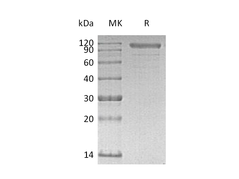 Recombinant Human CDH6 (C-6His)