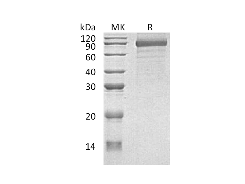 Recombinant Human CDH8 (C-6His)