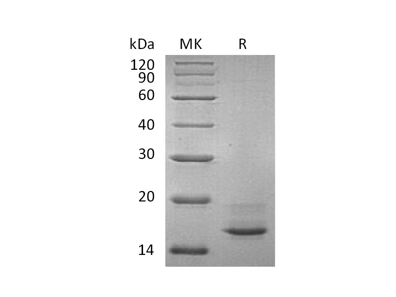 Recombinant Human CALCA (C-6His,Mammalian)