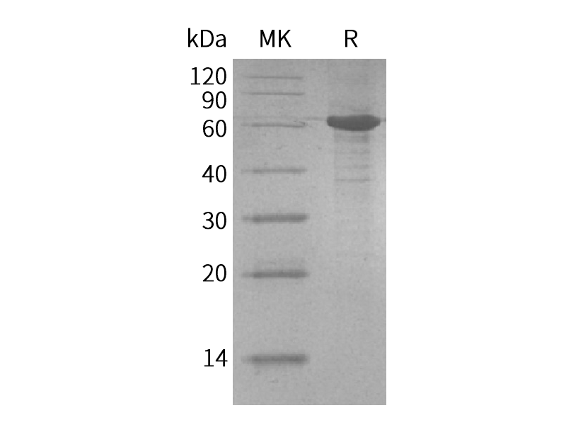 Recombinant Human Calmegin (C-6His)