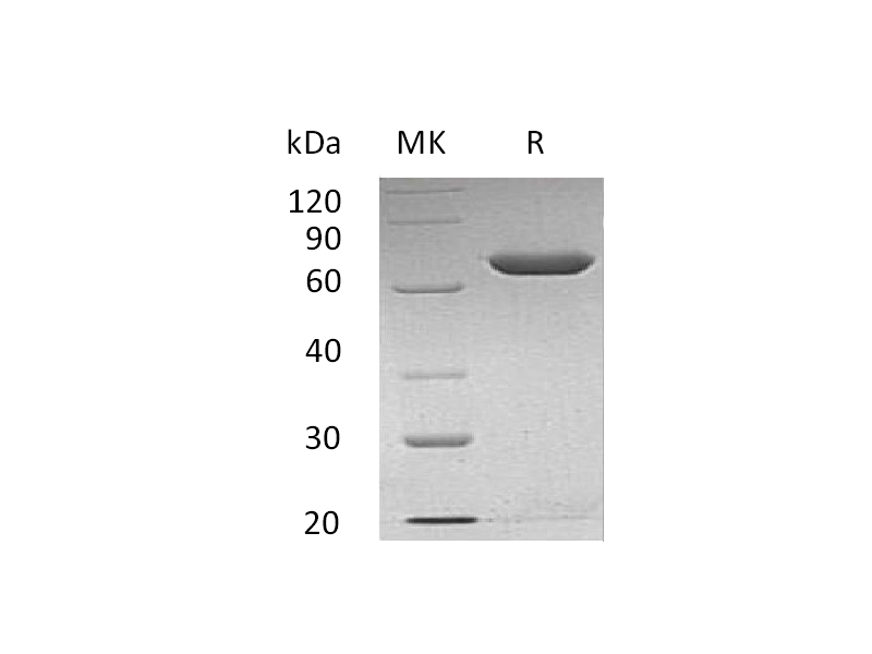 Recombinant Human Calnexin (C-6His)