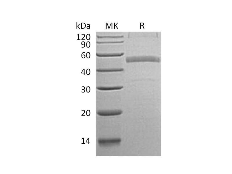Recombinant Human Calumenin (C-6His)