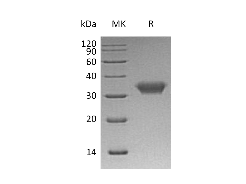 Recombinant Human CAR (C-6His)