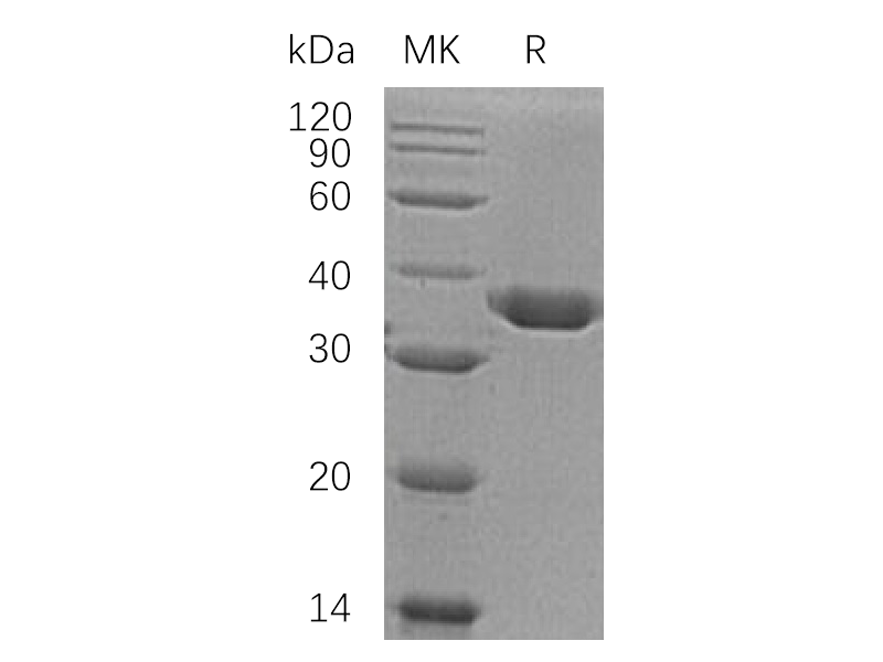 Recombinant Human Carbonic Anhydrase 10 (C-6His)