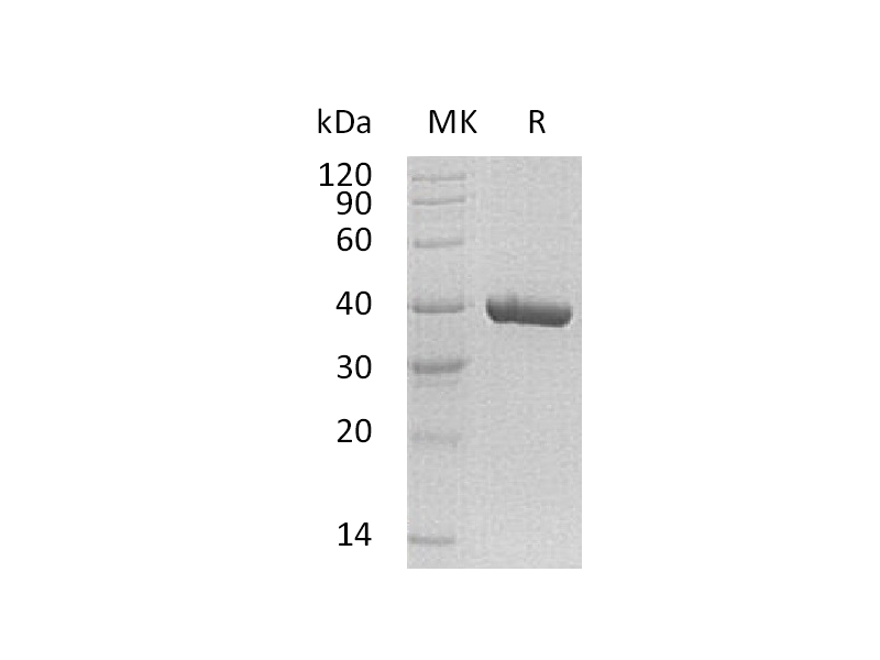 Recombinant Human Carbonic Anhydrase 11 (C-6His)