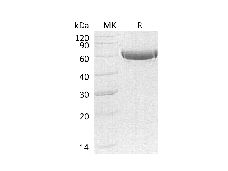 Recombinant Human CPB2 (C-6His)