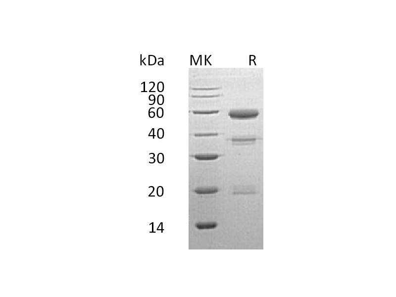 Recombinant Human CPE (C-6His)
