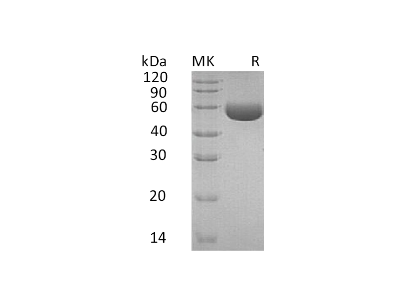 Recombinant Human CPM (C-6His)