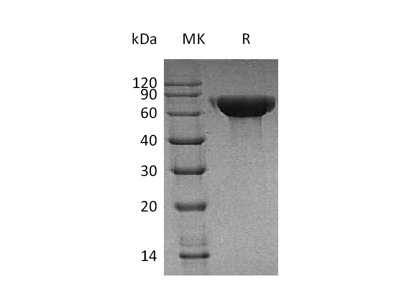 Recombinant Human CNDP1 (C-6His)