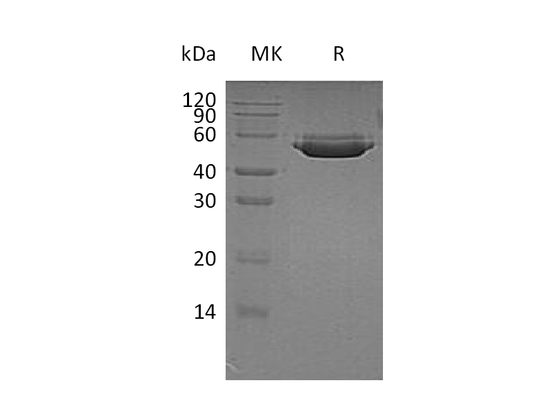 Recombinant Human CTSA (C-6His)