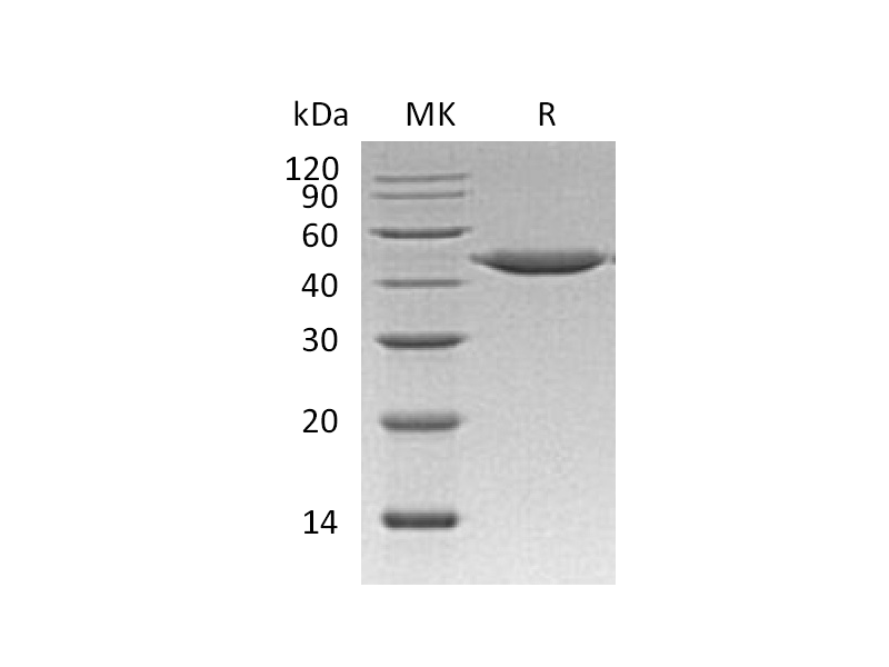 Recombinant Human CTSE (C-6His)