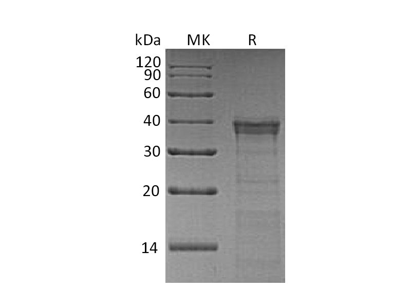 Recombinant Human CTSL2 (C-6His)