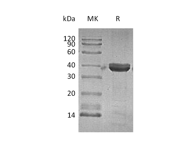 Recombinant Human CTSZ (C-6His)