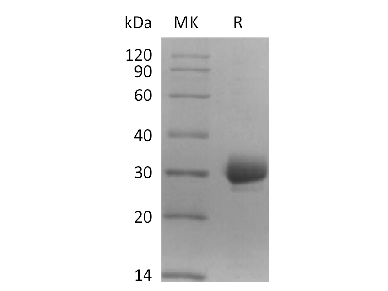 Recombinant Human CCDC134 (C-6His)