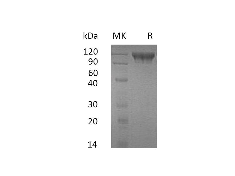 Recombinant Human SEMA4D (C-6His)