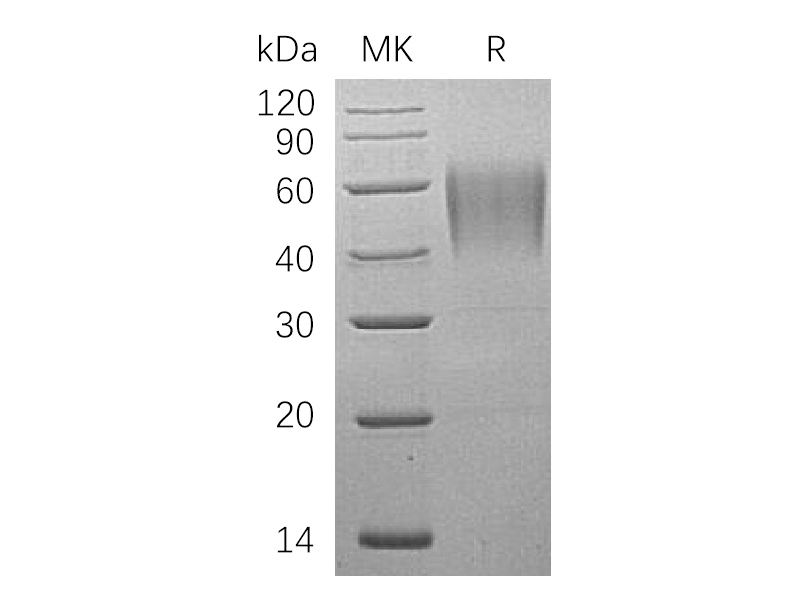 Recombinant Human ICAM-2 (C-6His)