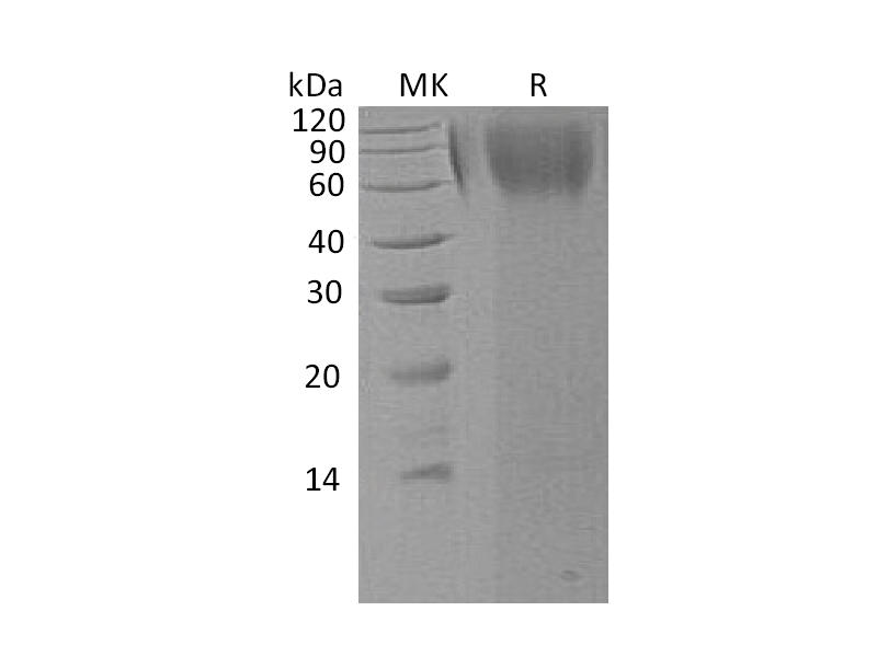 Recombinant Human LAMP1 (C-6His)