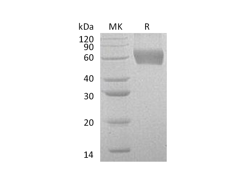 Recombinant Human CSF2RA (C-6His)