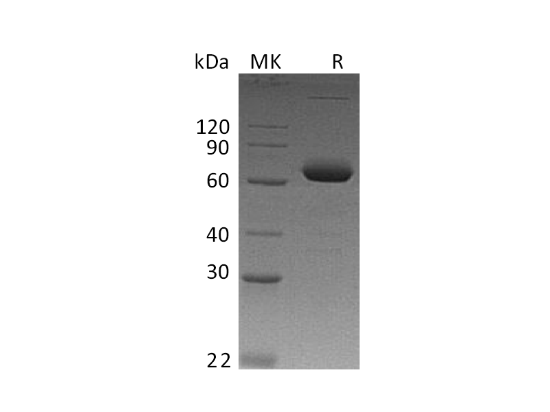 Recombinant Human IL-2RB (C-Fc)