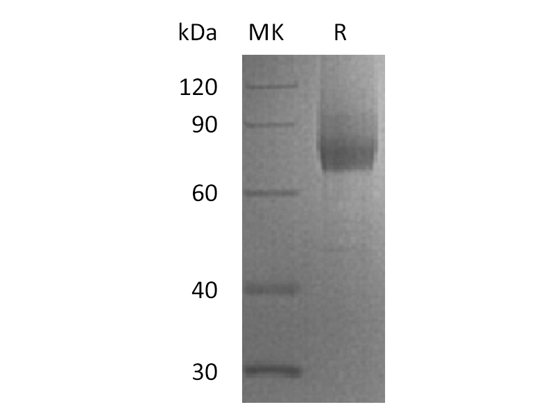 Recombinant Human IL-7RA (C-Fc-6His)