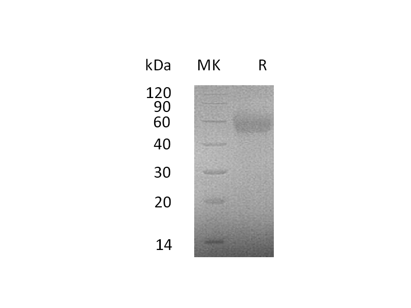 Recombinant Human IL-2RG (C-6His)