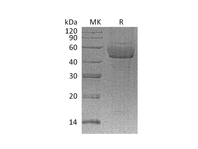 Recombinant Human SDC1 (C-6His)