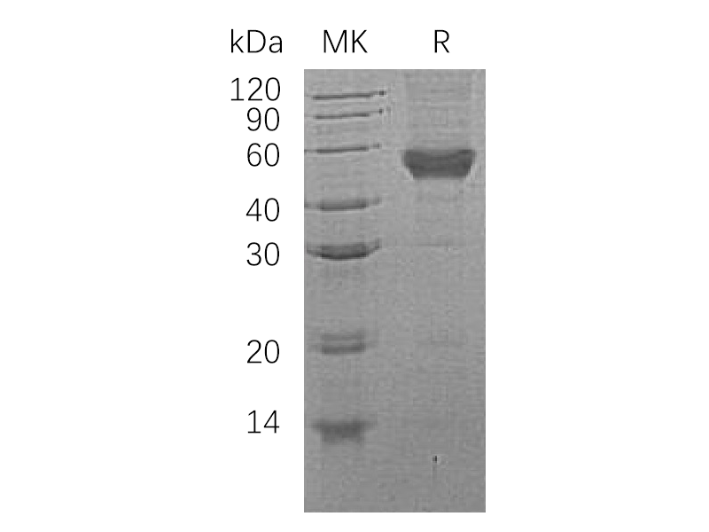 Recombinant Human CD14 (C-6His)
