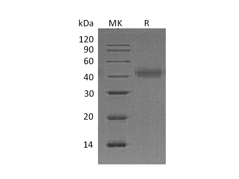 Recombinant Human TF (C-6His)
