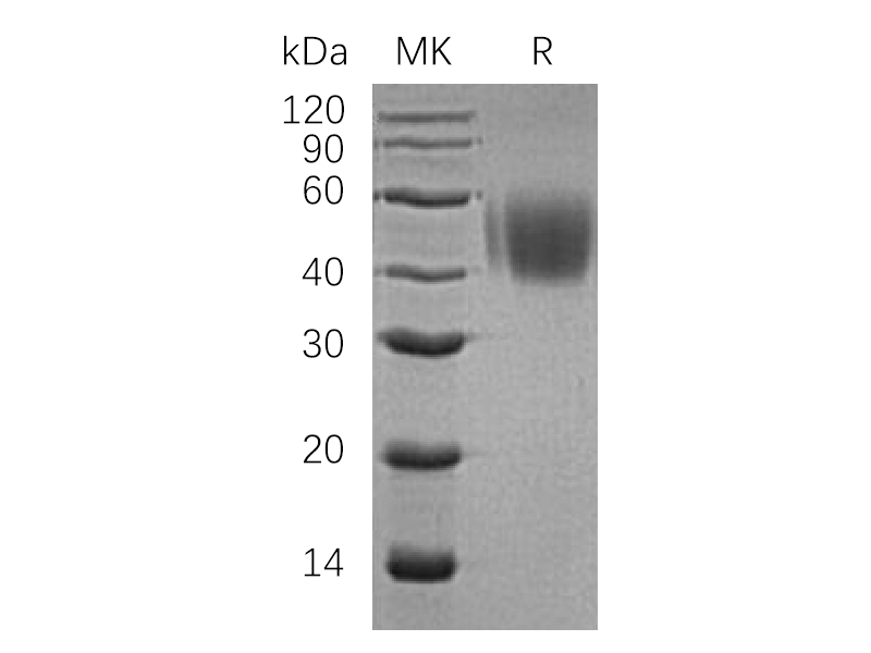Recombinant Human SLAMF1 (C-6His)
