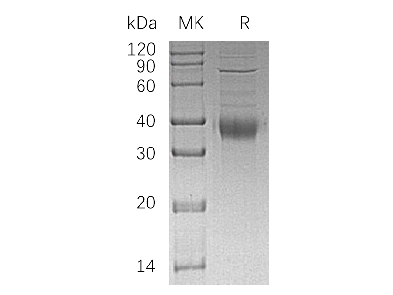 Recombinant Human KIR2DL4 (C-6His)