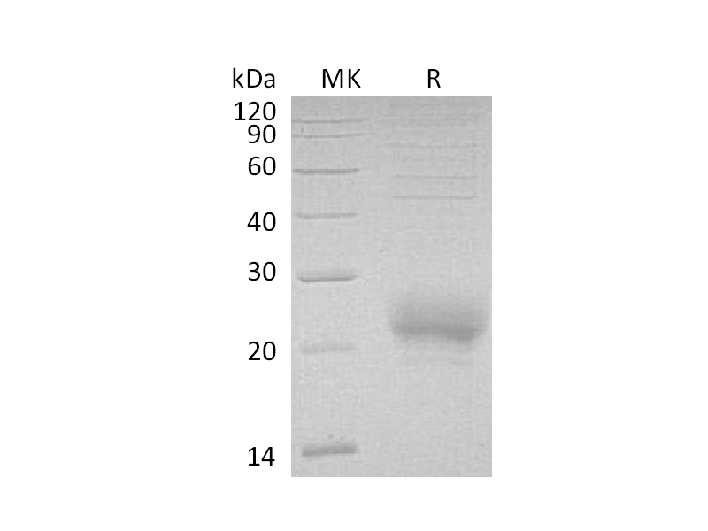 Recombinant Human CD160 (C-6His)