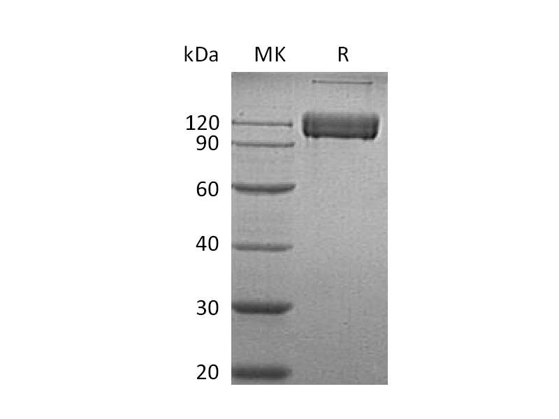 Recombinant Human ALCAM (C-Fc)