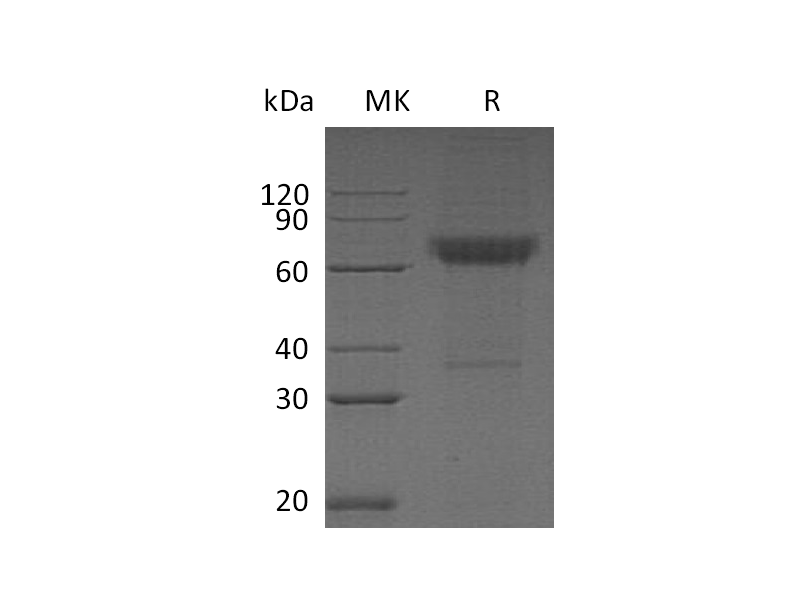 Recombinant Human CD16b (C-Fc-6His)