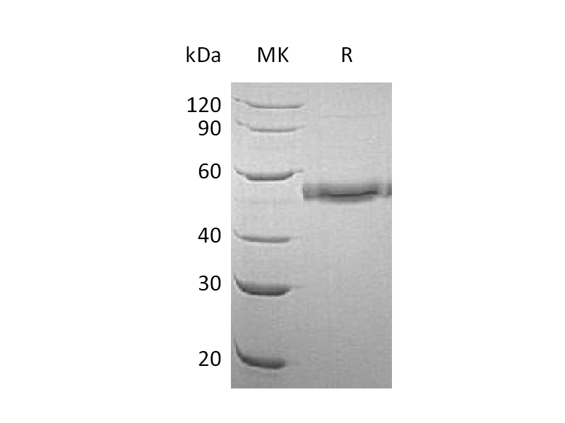 Recombinant Human CD177 (C-6His)